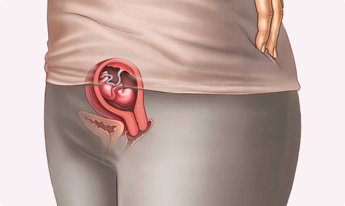 9 semanas de embarazo - Segundo mes - EMBARAZOYMAS