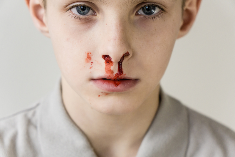 Flecha Compra calcio A mi hijo le sangra la nariz, ¿qué hago? - EMBARAZOYMAS