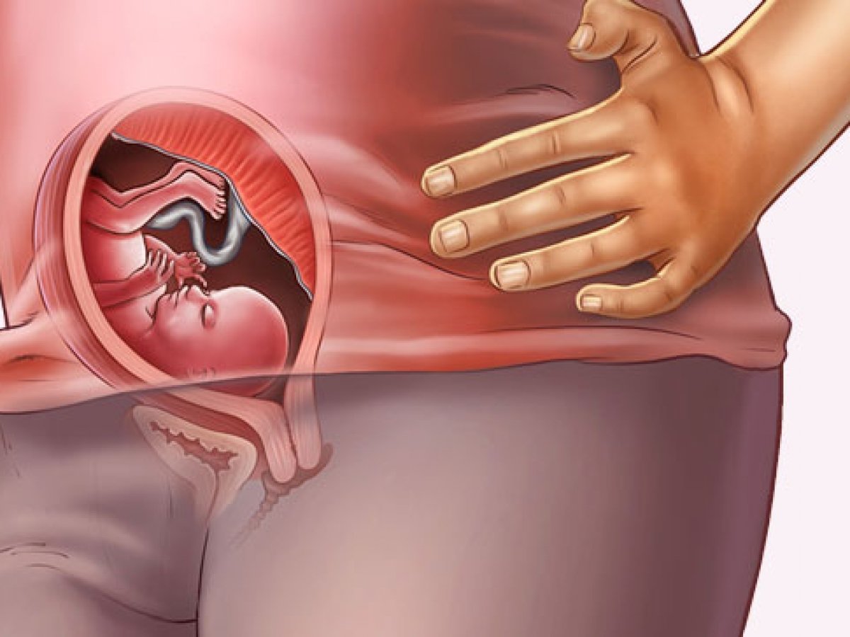 dolor abdominal bajo cuarto mes de embarazo dolor abdominal bajo cuarto mes de embarazo