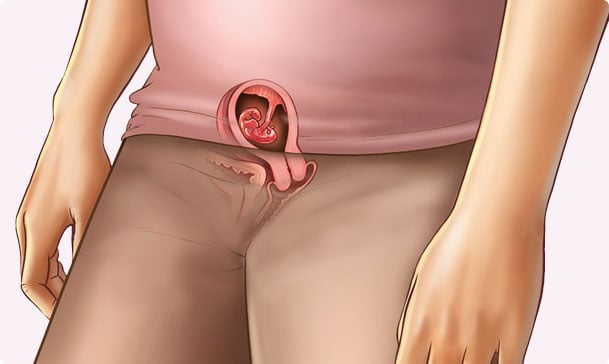 5 semanas de embarazo – Segundo mes