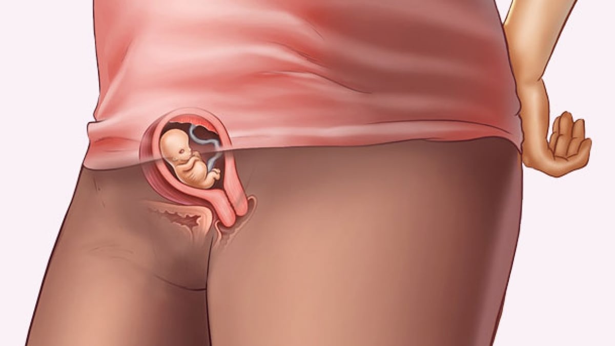 embarazada de 7 semanas sintomas