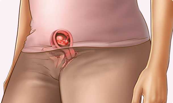 6 semanas de embarazo – Segundo mes