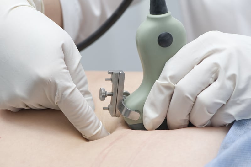La amniocentesis. ¿Qué es? ¿Es segura?