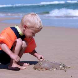 Picaduras de medusas en niños durante las vacaciones