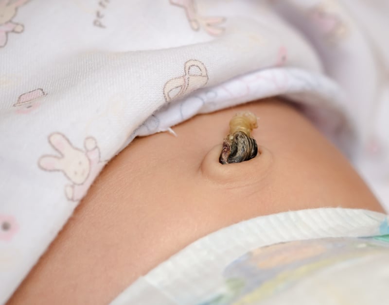 El cordón umbilical
