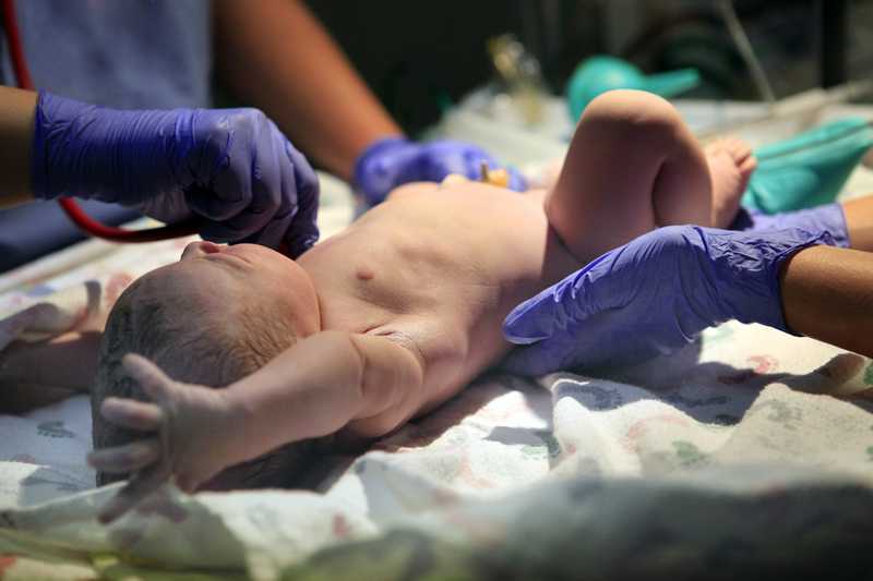 La cesárea en el parto: cómo recuperarse de una cesárea