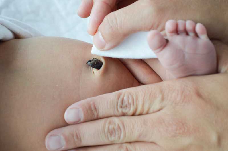 Cuidados Higiene Y Curas Del Ombligo Del Bebe Embarazoymas Cuidados Higiene Y Curas Del Ombligo Del Bebe Embarazoymas