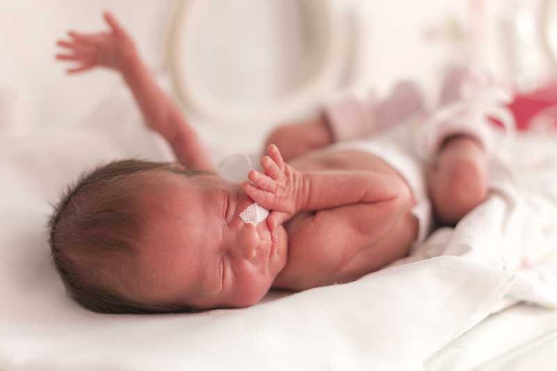 El Bebe Prematuro Embarazoymas El Bebe Prematuro Embarazoymas