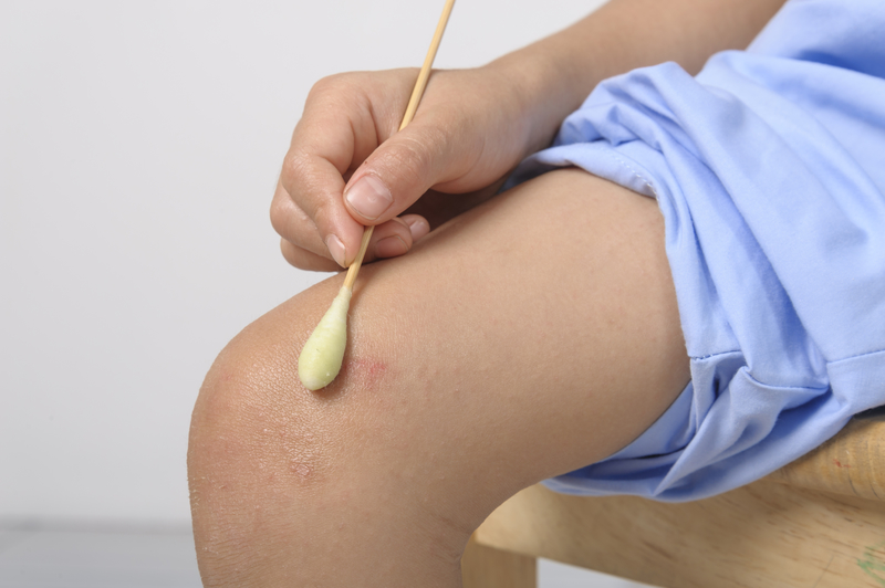 Urticaria infantil en bebés y niños