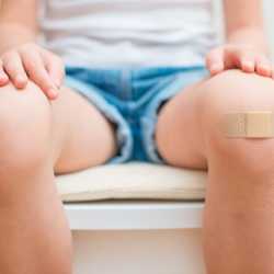 Cómo evitar la infección de una herida en los niños