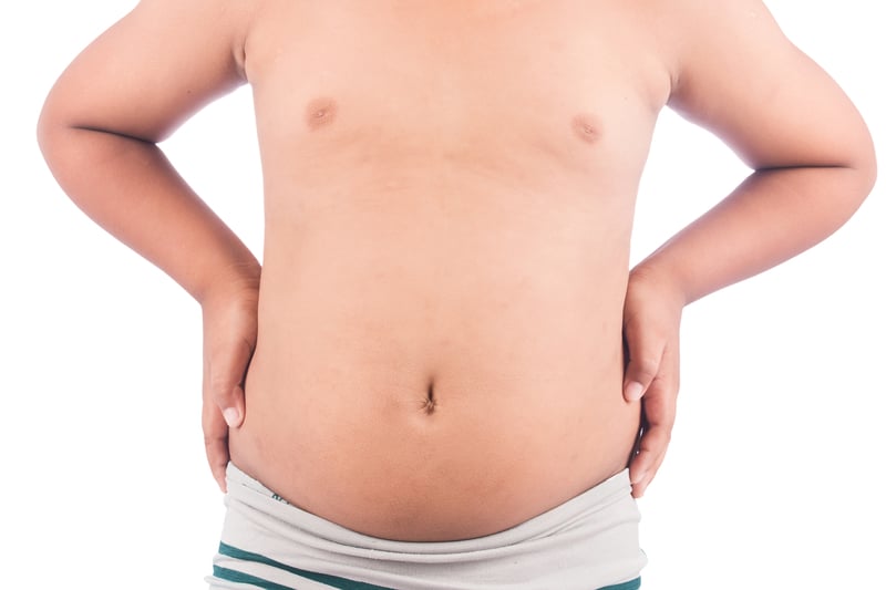 Obesidad infantil: problemas de sobrepeso en los niños