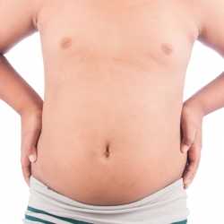 Obesidad infantil: problemas de sobrepeso en los niños