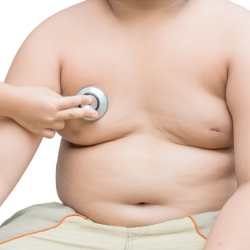 La obesidad infantil y la diabetes