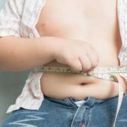 La obesidad infantil y sus consecuencias