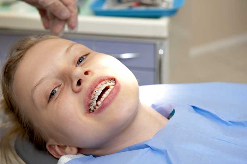 Ortodoncia infantil invisible: alternativas a los braquets