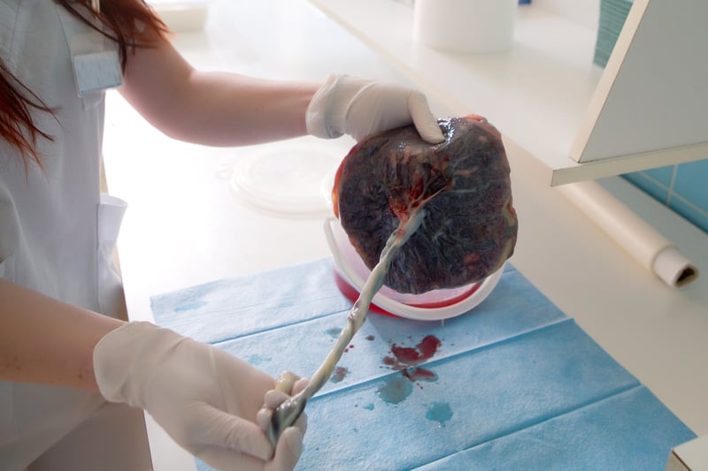 La placenta