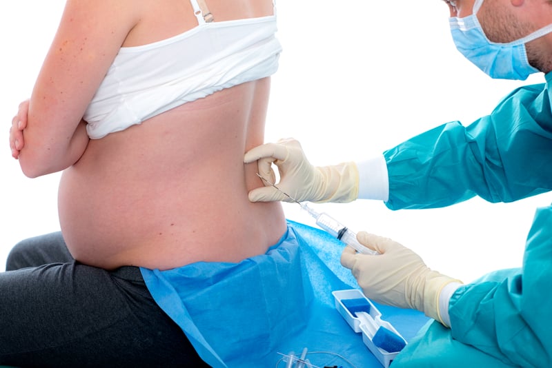Ventajas y desventajas de la epidural