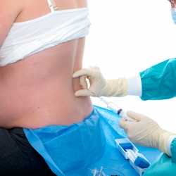 Ventajas y desventajas de la epidural