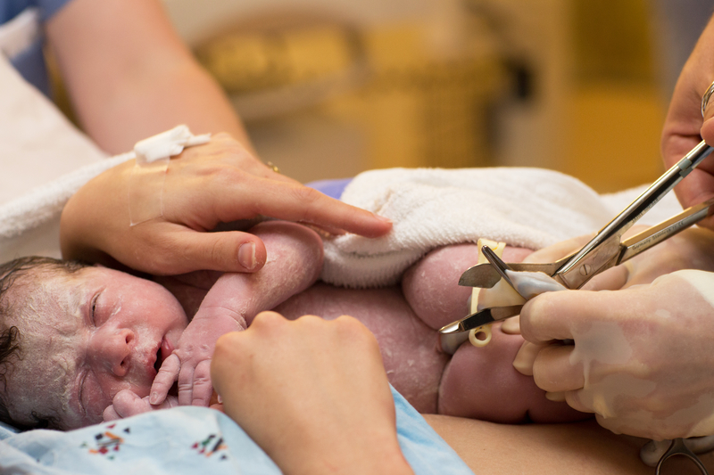 Cordón umbilical contra la leucemia
