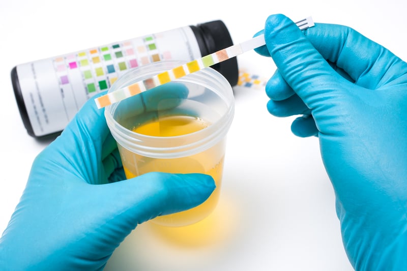 Diagnóstico de las infecciones urinarias durante el embarazo
