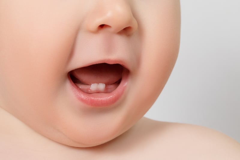 Resultado de imagen para bebe con dientes